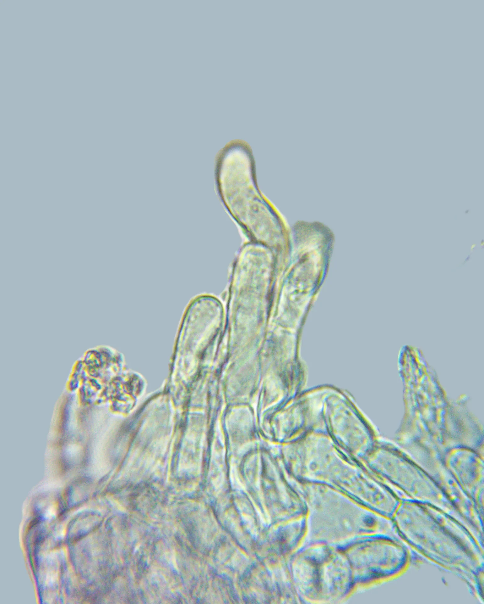 Exc. ectal, 1000X